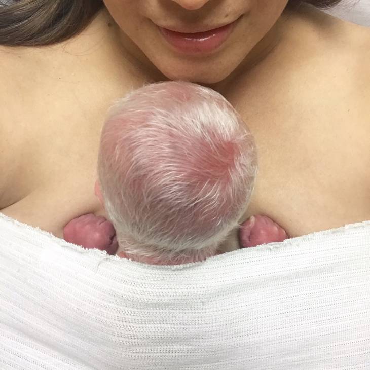 小孩睜眼才發現是白化症　夫妻曝「生4胎理由」：不會後悔