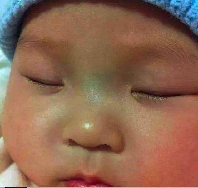 鼻樑的青筋到底咋回事?你一定要知道，鼻樑有青筋的寶寶，家長一定要好好愛他