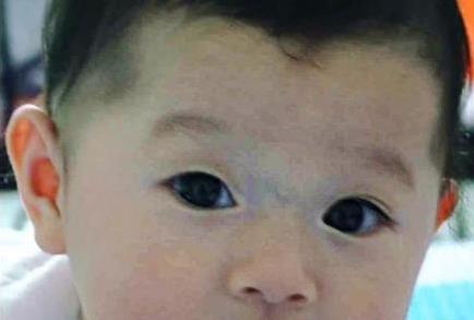 鼻樑的青筋到底咋回事?你一定要知道，鼻樑有青筋的寶寶，家長一定要好好愛他