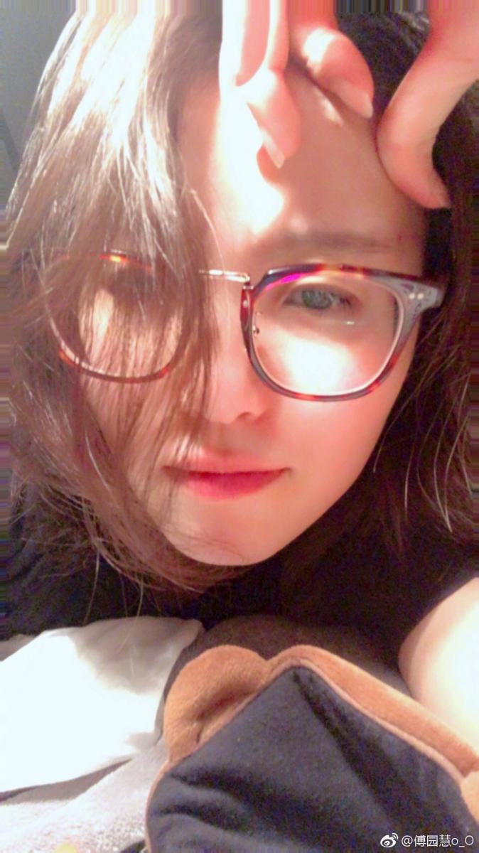 奧運「洪荒少女」矯正牙齒3年　露齒微笑近況照電翻男網友 