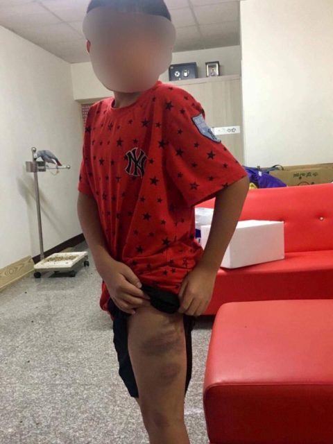 兒子因為「沒考到95分」被媽媽打成小花貓老爸求救，大家看到考卷上的紅字後卻挺媽媽！ 