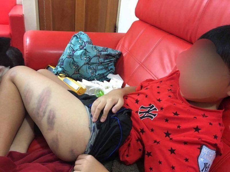 兒子因為「沒考到95分」被媽媽打成小花貓老爸求救，大家看到考卷上的紅字後卻挺媽媽！ 