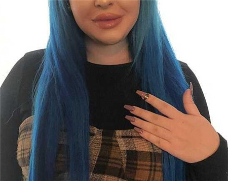不可思議！20歲女子打噴嚏時噴出戒指 系12年前丟失