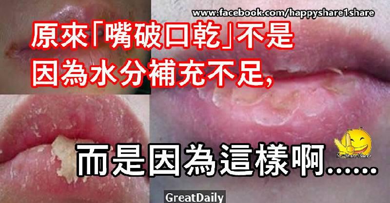 原來「嘴破口乾」不是因為水分補充不足，而是因為這樣啊！今天終於知道了！