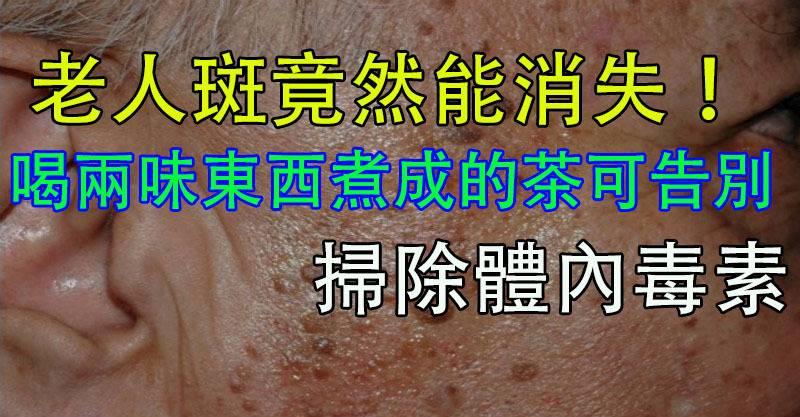老人斑！喝廚房裡的「兩味東西」煮成的茶可告別，掃除體內毒素，使健康光潤，推遲肌膚變老哦！