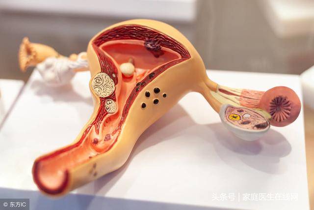 女人上廁所時，如果發現這4大問題，說明你的子宮不太健康了！