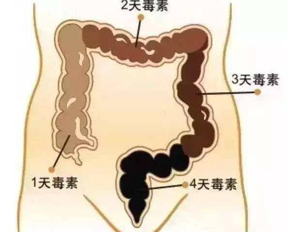 「大便」變細還帶血？最好去檢查一下，警惕腸道長腫瘤了