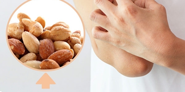 皮膚過敏發癢好不了？中醫師：先戒除「這食物」再說！