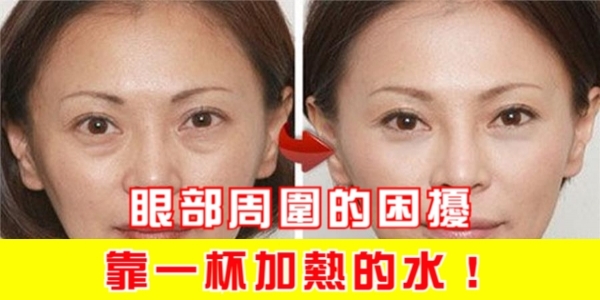 眼部周圍的困擾，就靠一杯加熱的水！