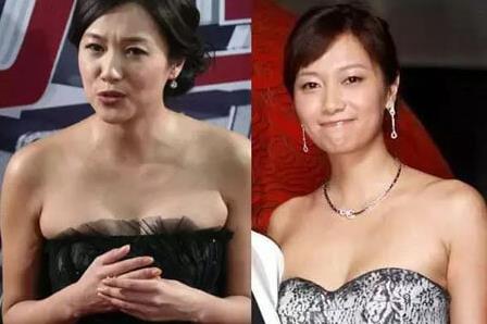 腋下「這塊肉」害你明明很瘦上半身卻顯厚　5個運動讓你美秀肩膀不用怕