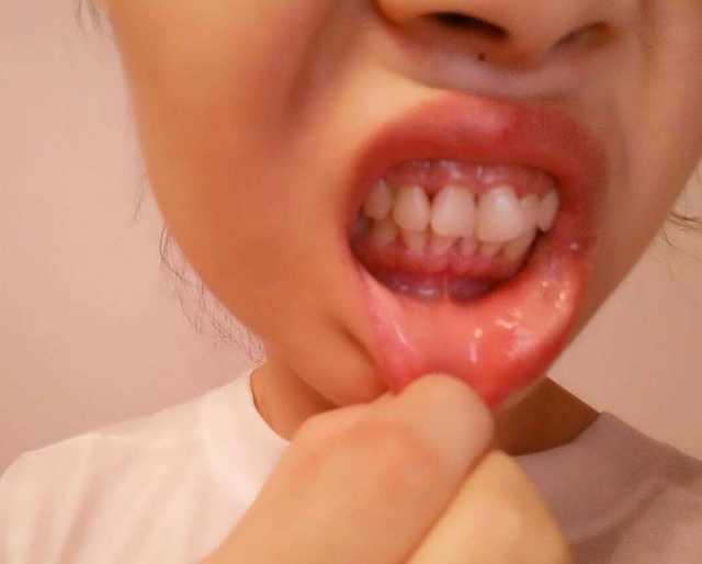 要預防肝臟受損，這「3種食物」千萬不能吃，吃一次，對肝臟的傷害就多一次