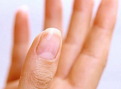 如果你「腎臟不好」你的指甲就會出現「這4個警告」很恐怖！不要不相信！