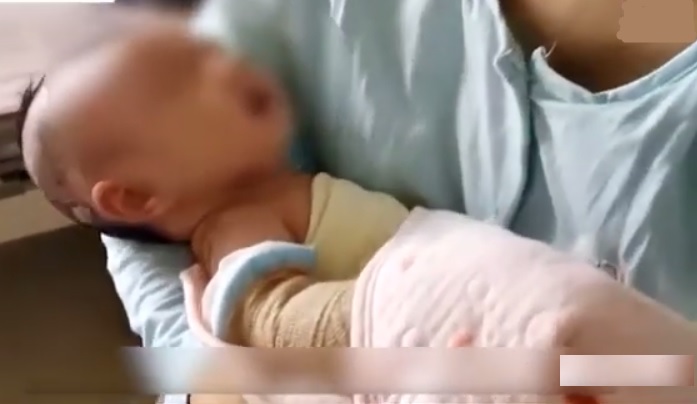 驚呆！新生兒雙腿雙腳「無皮膚」，猶如「透明寶寶」，父母被嚇到腿軟了！ 