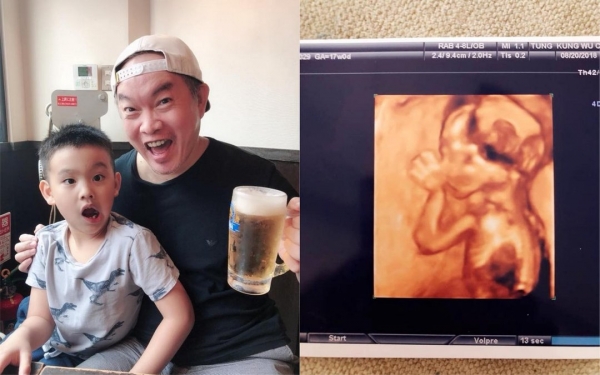 51歲「康康」開心再當爸！他興奮喊：「老婆又懷孕了！」PO出老婆超音波照「寶寶性別曝光」大家狂恭喜！