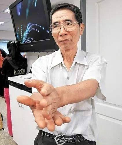 台灣名中醫，靠兩招治百病，不要一分錢！
