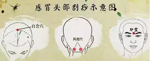 感冒、咳嗽、高燒，這樣刮一刮，就完事！收了吧！
