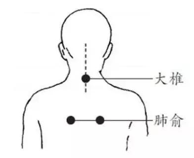 感冒、咳嗽、高燒，這樣刮一刮，就完事！收了吧！