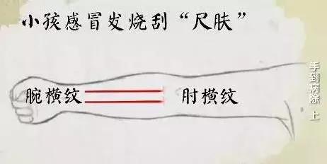 感冒、咳嗽、高燒，這樣刮一刮，就完事！收了吧！