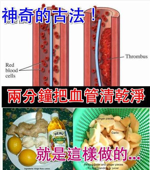 通血管的古方，花2分鐘就能給父母和親朋好友的超級大禮！