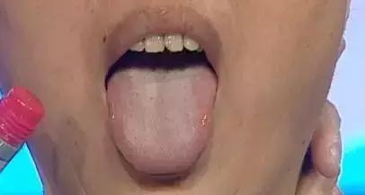 常按兩穴位，健脾又祛濕，原來可以這麼容易！