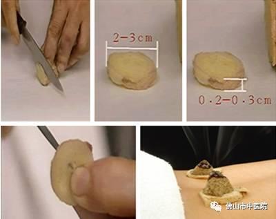 春天巧用這穴位，對養陽大有益處！（附操作手法）
