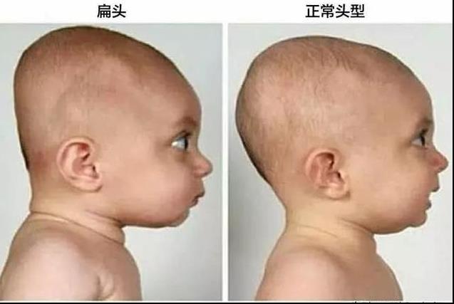 這8個壞習慣讓很多孩子「越長越醜、越來越笨」，父母一定要及時糾正