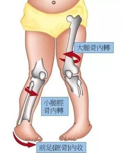 這8個壞習慣讓很多孩子「越長越醜、越來越笨」，父母一定要及時糾正