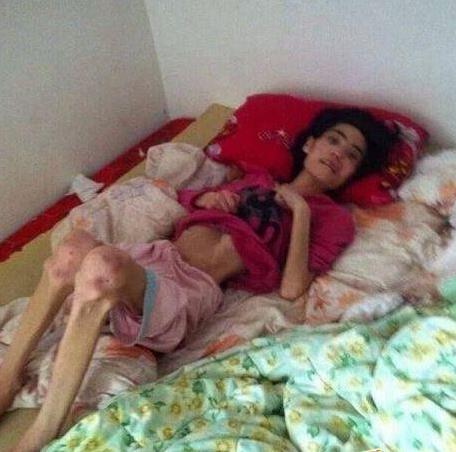 為了維護出軌兒子，婆婆將漂亮兒媳，虐待餓成40斤骷髏...！原本模樣長得很美阿...可憐