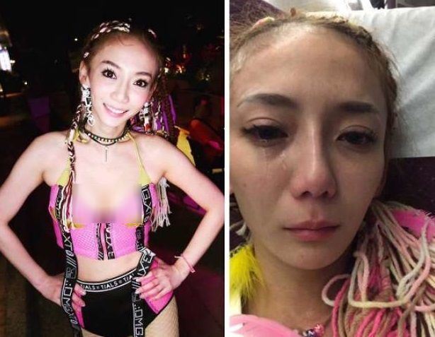 違禁品毀鼻… 劉喬安「整形後照」首度曝光！70萬修修臉成果這樣 網嚇呆：值得