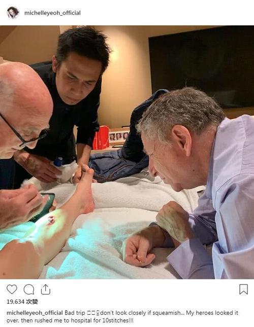 楊紫瓊腿部意外受傷縫10針，73歲未婚夫趴在床上一臉愁容！