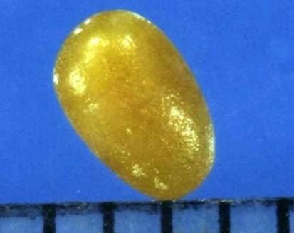 科學角度解釋：舍利子究竟是什麼？