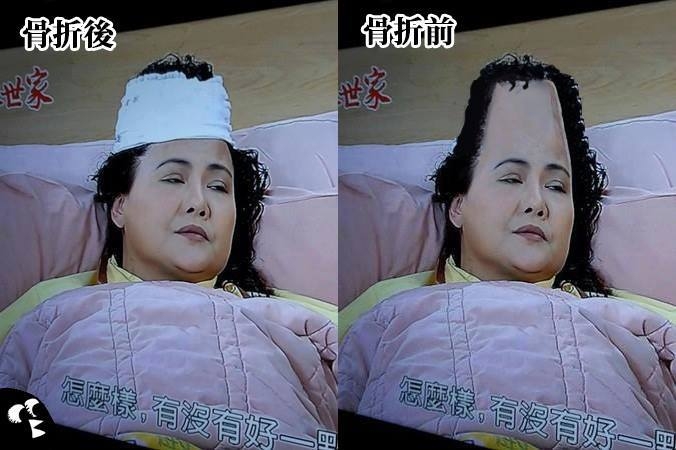 5 個「如果把頭髮剃掉的話」會變醜八怪的人物，小蘭姐姐第一名！