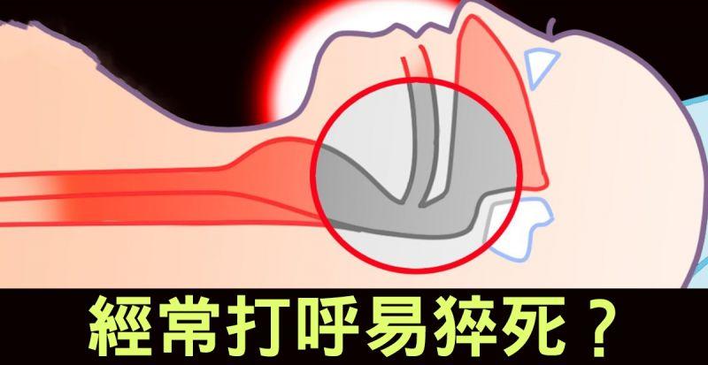 睡不好會要命！經常「打呼」腦栓塞風險多10倍！暢通氣管「六步驟」睡好睡滿