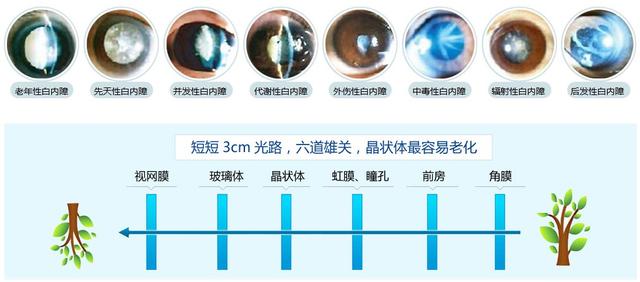 3種植物泡水喝，巧治眼疲勞、老花眼！
