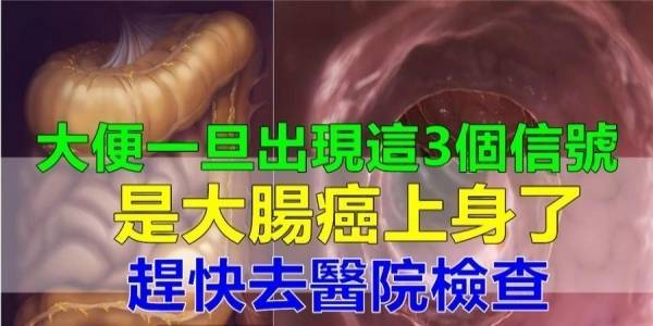 腫瘤專家警告：大便出現3個訊號，是大腸癌。。