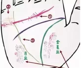 做自己的醫生：24種身心問題的手診圖解，收了吧！