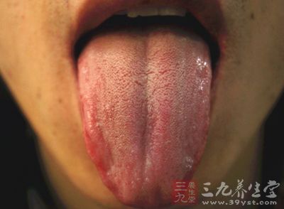 注意！身體出現這「９種徵兆」竟是「腎虛」的信號！千萬別到體虛累積出大病才知道！ 