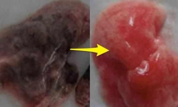 夫妻堅持吃這種水煮菜一個月，腎部居然年輕了20歲！男女老少都需要~