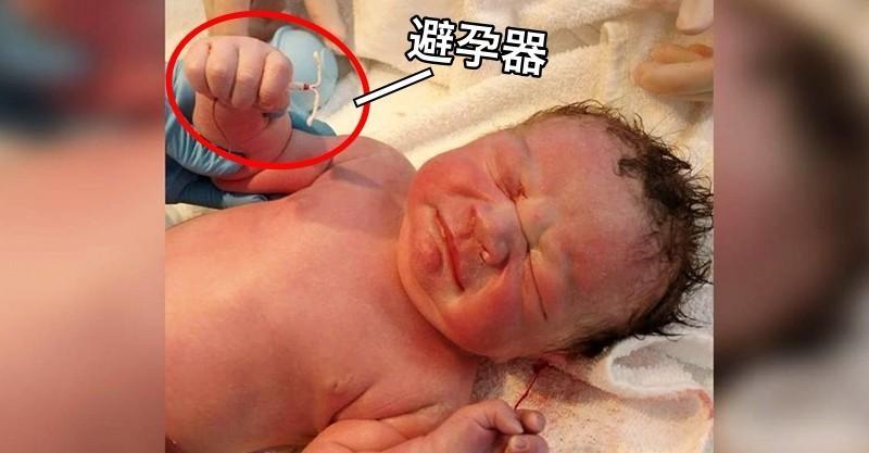 地表最強嬰兒！小男嬰「手抓著媽媽避孕器」強勢出生，照片秒飆破7萬人按讚：1%的奇蹟！ 