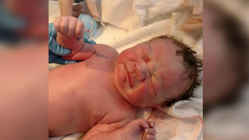 地表最強嬰兒！小男嬰「手抓著媽媽避孕器」強勢出生，照片秒飆破7萬人按讚：1%的奇蹟！ 