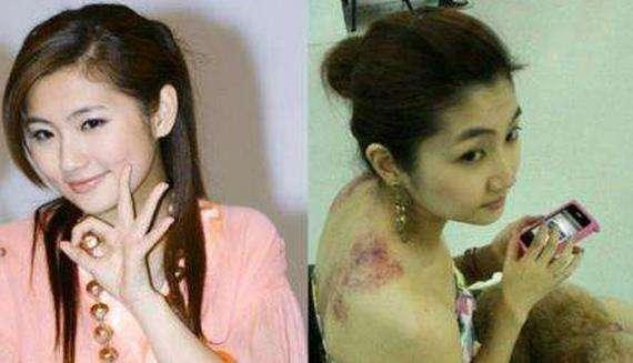 任家萱重度燒傷後都用美顏濾鏡自拍，與外婆合照臉上褶子都磨平了！