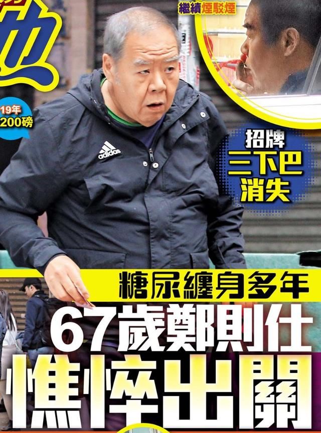肥貓鄭則仕受糖尿病纏身，日漸消瘦頭髮斑白身體堪憂！