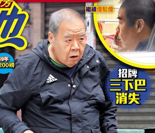 肥貓鄭則仕受糖尿病纏身，日漸消瘦頭髮斑白身體堪憂！