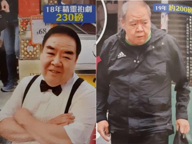 肥貓鄭則仕受糖尿病纏身，日漸消瘦頭髮斑白身體堪憂！