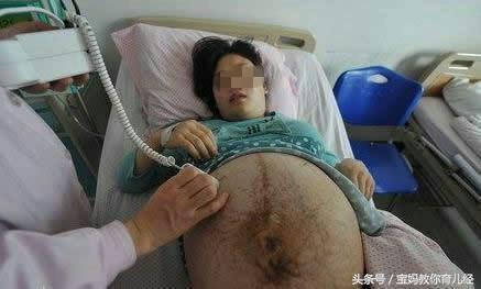  四胞胎孕媽38周遲遲不生，婆婆跪求阻止手術，剖開肚子醫生絕望搖頭！