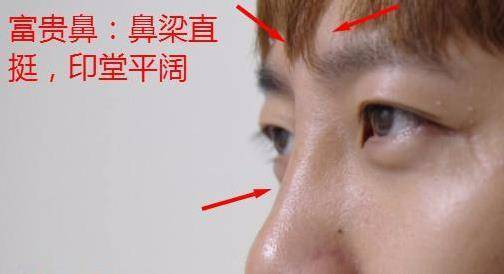 鼻樑上這3個特徵，是「隱藏富翁」的象徵，遇見了可千萬不要得罪