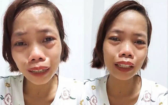 單親媽直播賺錢被笑「妳長得好像河童！」　 節目出錢讓她整形「變身韓系電眼女神」正到逆齡20歲