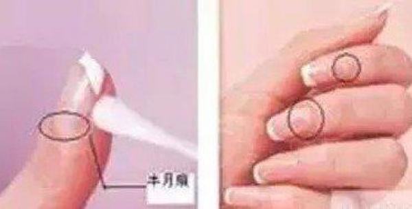 從手指甲就可以看出一個人的健康！你知道指甲上一條一條的橫紋縱紋代表什麼意思嗎？