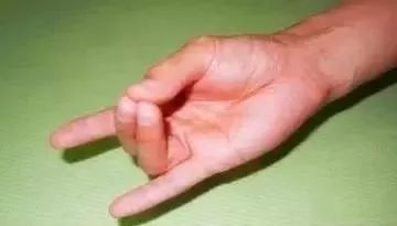 太神奇了!把三個手指放到一起,竟然能補腎 排毒 明目 防心梗