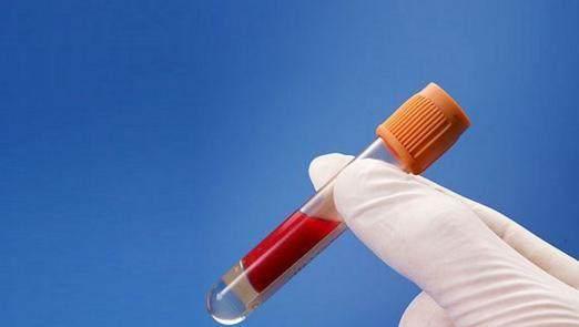 胃潰瘍患者喝牛奶，會加重胃痛嗎？天天喝牛奶，很多人喝錯了